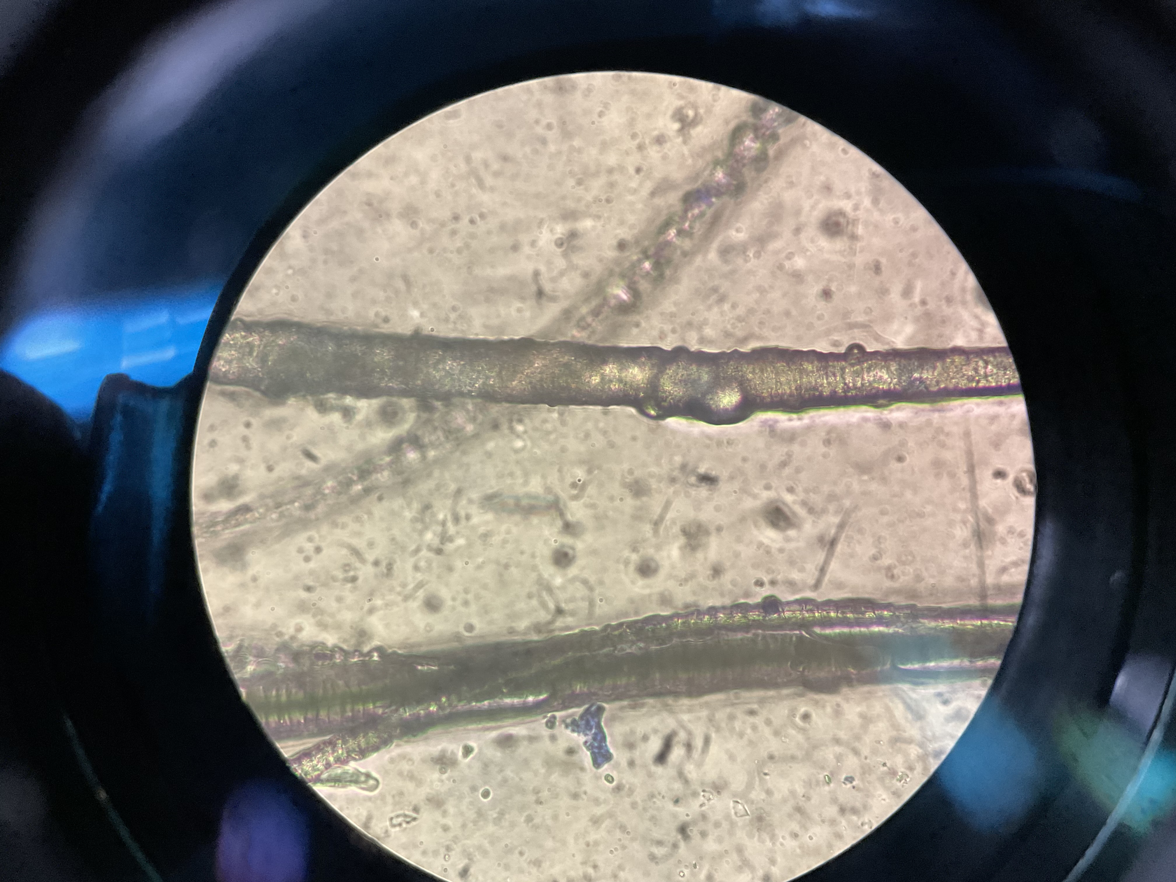 皮膚糸状菌症の顕微鏡写真